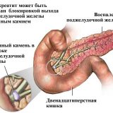 Воспаление-поджелудочной